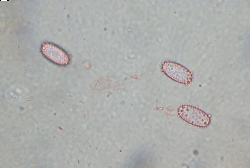 Peziza echinospora        P. Karst.,